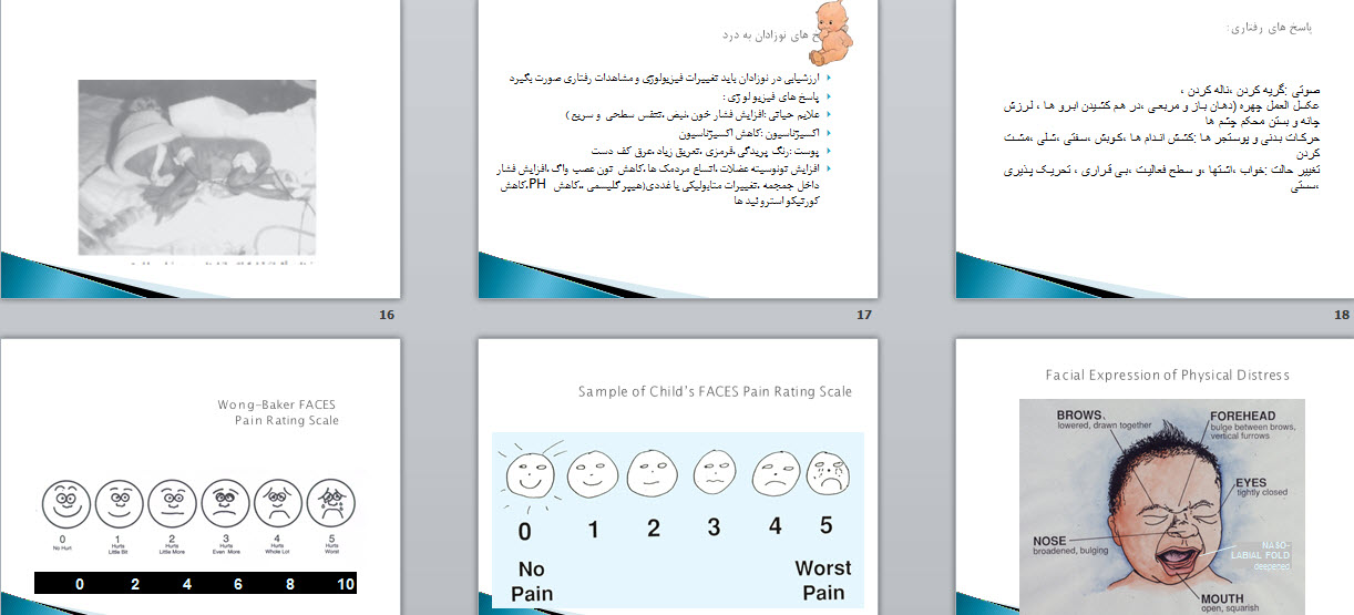 پاورپوینت مراقبت و تدابير پيشرفته پرستاری ويژه با تاكيد بر نوزاد نارس