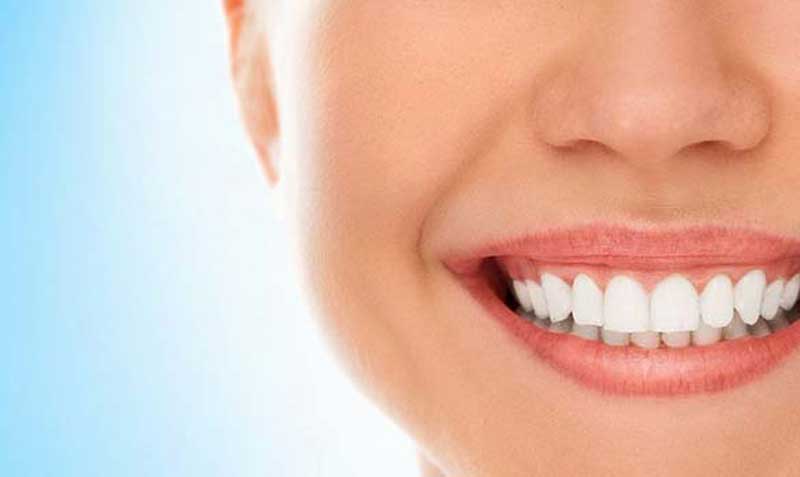 اصلاح لبخند با ایمپلنت دندان