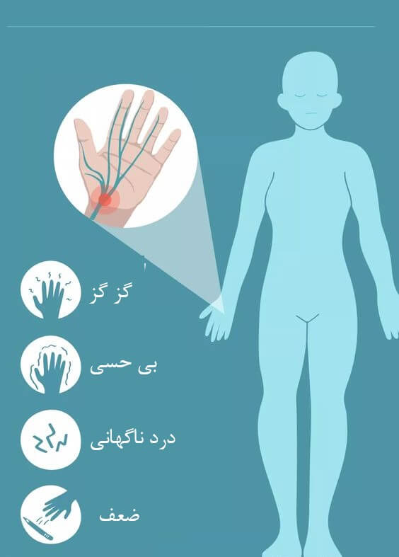 نشانه آرتریت در دست