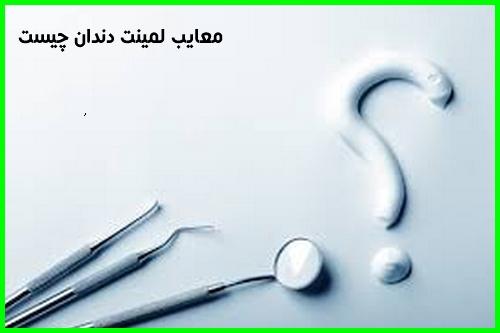 لمینت متحرک دندان