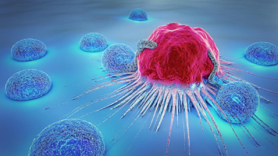 7 واقعیت تسلی بخش در مورد بیماری سرطان cancer