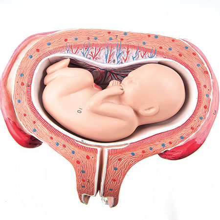 روش های حل مشکل جنین عرضی در شکم transverse fetus